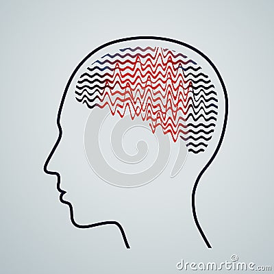 Human brain with epilepsy activity, vector illustration Vector Illustration