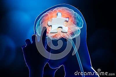 Human brain profile with jigsaw puzzle part design 3D rendering illustration. Amnesia, Alzheimer`s, memory loss or impairments, Cartoon Illustration