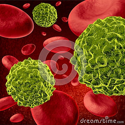 Human cancer Stock Photo