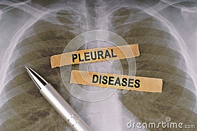On a human chest x-ray, a pen and strips of paper labeled - PLEURAL DISEASES Stock Photo
