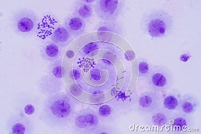 Human chromosomes under microscope view Stock Photo