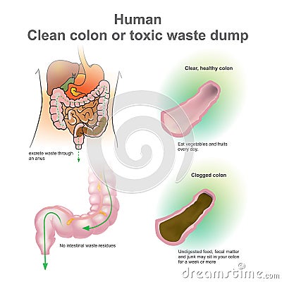 Human Clean colon or toxic waste dump. Vector, Illustration. Vector Illustration