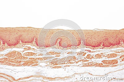 Human esophagous mucosa Stock Photo