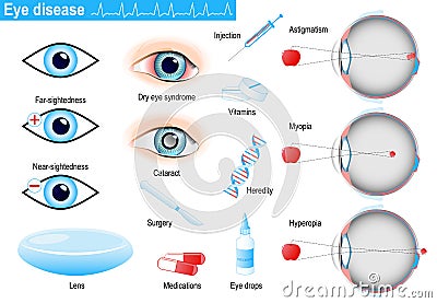 Human eye diseases and disorders. Infographic Vector Illustration