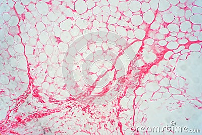 Human fat body tissue under microscope view Stock Photo