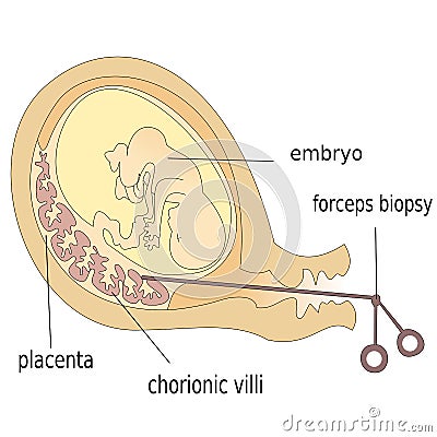 Human fetus Stock Photo