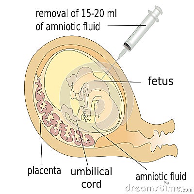 Human fetus Stock Photo