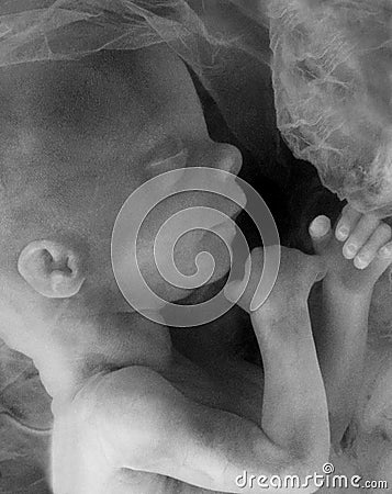 Monochrome image of a Human Fetus Stock Photo