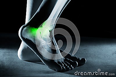 Human foot ankle and leg in x-ray, on gray background Stock Photo