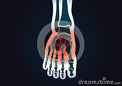 Human foot bone have a red signal Vector Illustration