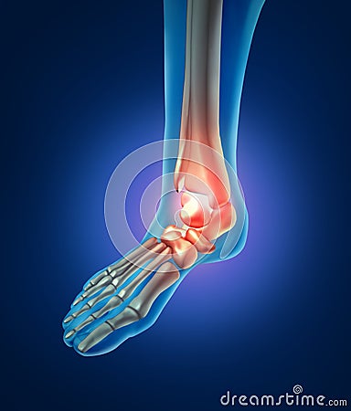 Human Foot Pain Stock Photo