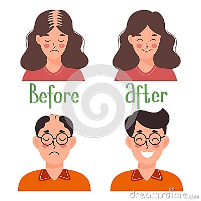 Human hair transplant. Woman and man before and after transplantation. Health care and medicine. Cartoon illustration Vector Illustration