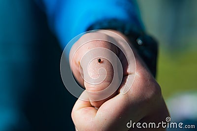 Human hand the bitten tick encephalitis Stock Photo