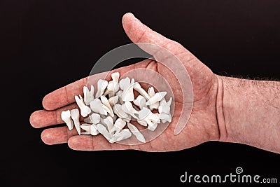 Teeth implant and crown installation process parts isolated on a blue background. Medically accurate 3D model. Stock Photo
