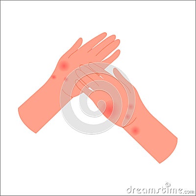 Human hands with allergic reaction Cartoon Illustration