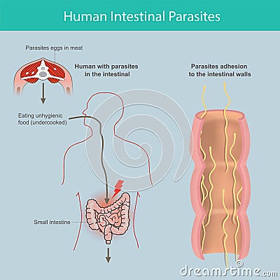Human Intestinal Parasites. Vector Illustration