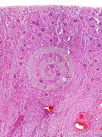 Human kidney. Renal cortex Stock Photo