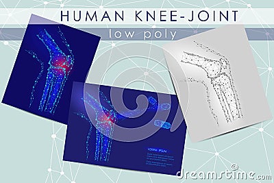 Human knee-joint low poly medicine science illustration set. Knee anatomical pain cure concept. Help keep health drug Vector Illustration