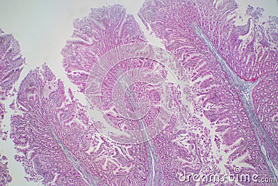 Human large intestine tissue under microscope view. Stock Photo