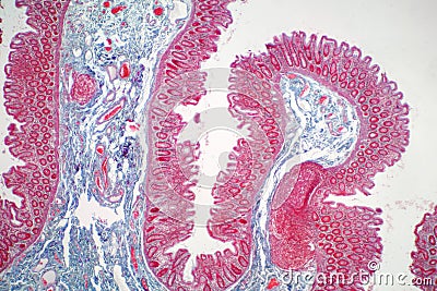 Human large intestine tissue under microscope view. Stock Photo