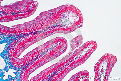 Human large intestine tissue under microscope view Stock Photo