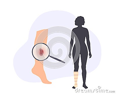 Human leg injury Vector Illustration