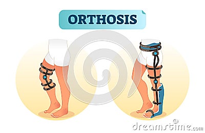 Human leg orthosis medical equipment vector illustration. Vector Illustration