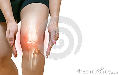 Human leg Osteoarthritis inflammation bone joints Stock Photo