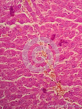 Human liver tissue Stock Photo