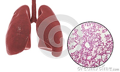 Human lungs anatomy and histology Cartoon Illustration