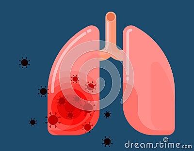 Human lungs infected by virus on blue background Vector Illustration