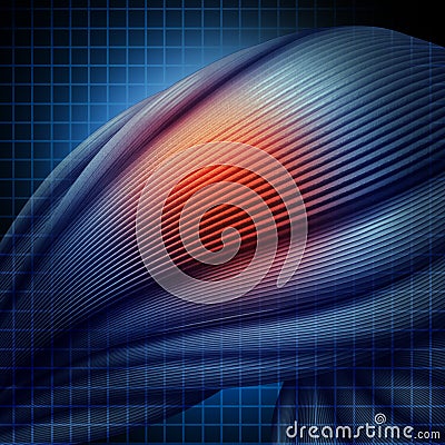 Human Muscle Injury Stock Photo