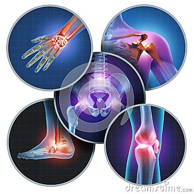 Human Painful Joints Stock Photo