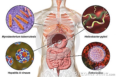 Human pathogenic microbes, respiratory and enteric pathogens Cartoon Illustration