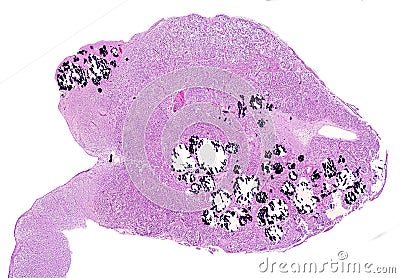 Human pineal gland. Calcareous concretions Stock Photo