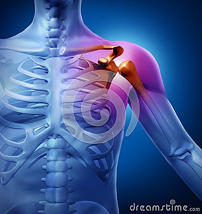 Human Shoulder Pain Cartoon Illustration