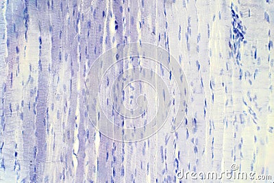 Human skeletal muscle tissue under microscope view for education histology Stock Photo