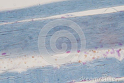 Human skeletal muscle under microscope view for education histology. Stock Photo