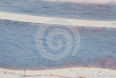 Human skeletal muscle under microscope view for education histology. Stock Photo