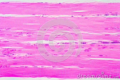 Human skeletal muscle under microscope view for education pathology Stock Photo
