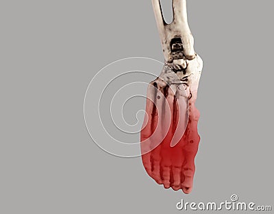 Human skeleton foot with red point at forefoot. Injury, excessive physical activity, ill-fitting shoes consequences Stock Photo