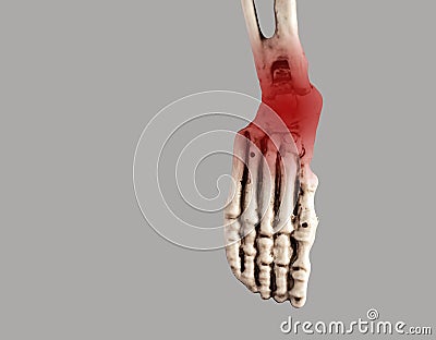 Human skeleton foot with red point at heel and ankle. Injury, plantar fasciitis, tendinitis consequences. Medical Stock Photo