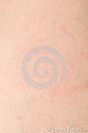 Human skin texture with black hairs on the skin for healthy back Stock Photo