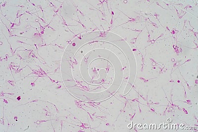 Human sperm morphology under microscope. Stock Photo