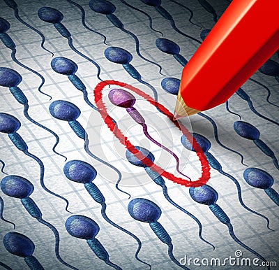 Human Sperm Selection Stock Photo