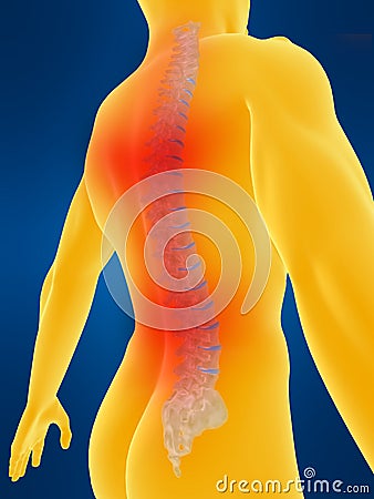 Human spine with backache Cartoon Illustration