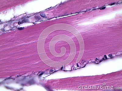 Human striated muscle under microscope Stock Photo