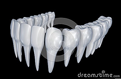 Human Teeth instalation. Medically accurate dentistry anatomy Stock Photo