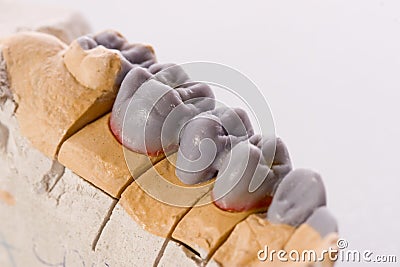 Human teeth, model Stock Photo