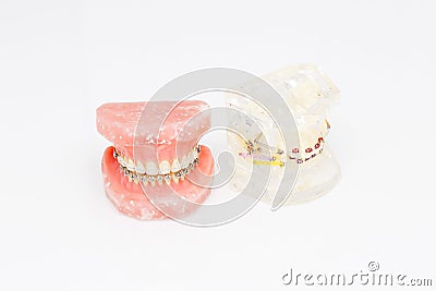 Human teeth orthodontic dental model with implants, dental braces Stock Photo
